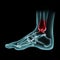 Bone foot isolatedâ€‹ onâ€‹ blackâ€‹ background.X-Ray film forâ€‹ checkâ€‹ ,diagnosis orâ€‹ analysis brokenâ€‹ boneâ€‹ pain for