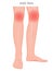 Bone fracture_Knee pain