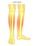 Bone fracture_Shin pain bones of the leg