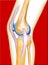 Bone knee
