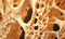 Bone structure in osteoporosis. vitamin D deficiency, fractures, estrogen