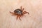 Borrelia Infected Tick Insect Crawling on Skin. Dermacentor reticulatus. Encephalitis Virus or Lyme Borrelia Disease Infectious