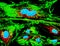 Bovine pulmonary arthery cells