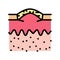 boxcar acne scar color icon vector illustration