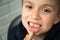 A boy of 6-7 years old shows the first teeth that grow after the loss of milk teeth