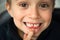 A boy of 6-7 years old shows the first teeth that grow after the loss of milk teeth. Close-up