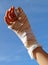 Boy with bandaged hand for an injury playing