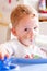 Boy with bruise drinking milk