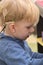 Boy With A Hearing Aids And Cochlear Implants