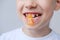 Boy, kid holds in his mouth and eats gelatinous sweets, gummy bear, concept of children`s delicacy, healthy and unhealthy food,