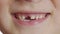 The boy mouth without a tooth. Baby teeth. Changing teeth. Oral care. Closeup, 6k.