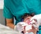 Boy and orthodontist inserting blue ligatures