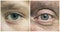 Boy\'s eyes and men\'s eyes