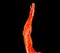 Brachial Arteries of the arm with Upper extremity Bone 3D rendering from CT Scanner