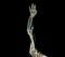 Brachial Arteries of the arm with Upper extremity Bone 3D rendering from CT Scanner