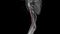 The brachial artery is the chief artery supplying blood to the arm, forearm, and hand