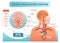 Brain circulatory system anatomical vector illustration diagram. Human brain blood vessel network scheme.