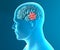 Brain degenerative diseases Parkinson