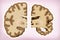 Brain difference in Alzheimer`s, This illustration shows the comparison of two halves of the brain, one healthy half and the other