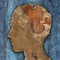 Brain Disease And Dementia