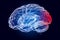 Brain, disease of occipital lobe concept. 3D rendering