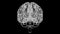 Brain Interventricular foramen Anatomy For Medical Concept 3D