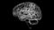 Brain Interventricular foramen Anatomy For Medical Concept 3D