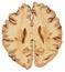 Brain - Lower Region Cross Section