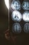Brain MRI and dementia