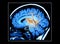 Brain MRI Scan Mouse Wheel
