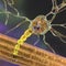 Brain neurons in Tay-Sachs disease, 3D illustration