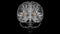 Brain putamen Anatomy For Medical Concept 3D Animation