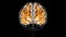 Brain White matter of cerebral hemisphere Anatomy For Medical Concept 3D