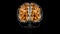 Brain White matter of cerebral hemisphere Anatomy For Medical Concept 3D