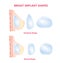 Breast implant Silicone compare round and tear drop, Breast surgery