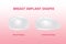 Breast implant, Silicone shape, round shape and teardrop