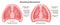 Breathing mechanism. Anatomical mechanism of the healthy human lungs