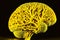 bright yellow model of human brain depicting vessels and convolons