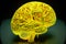 bright yellow model of human brain depicting vessels and convolons