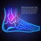 A broken ankle x-ray. Anatomy of the ankle. Pain in ankle