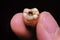 Broken Caries Molar on Male Hand iSolated Black Background