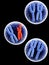 Broken red X chromosome and full blue X chromosomes