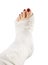 Broken woman leg in gypsum bandage