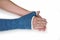 Broken wrist, arm with a blue fiberglass cast