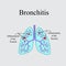 Bronchitis. The anatomical structure of the human lung. Vector illustration on a gray background