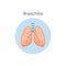 Bronchitis a lung disease medical anatomical diagram vector illustration isolated.