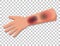 Bruised skin on an arm isolated on transparent background