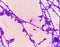 Budding yeast cells with pseudohyphae