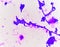 Budding yeast cells with pseudohyphae