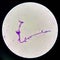 Budding yeast cells with pseudohyphae in urine sample on wright gimsa stain